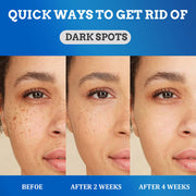 Fade Spot Cream Brightening White Moisturizing Cream