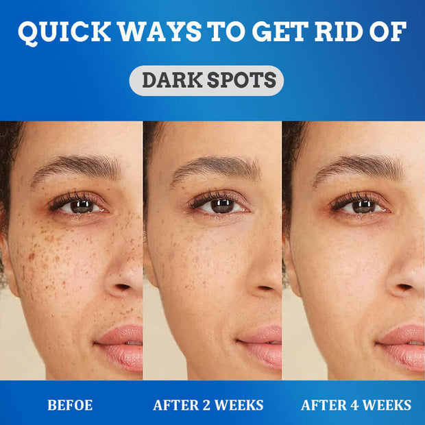 Fade Spot Cream Brightening White Moisturizing Cream