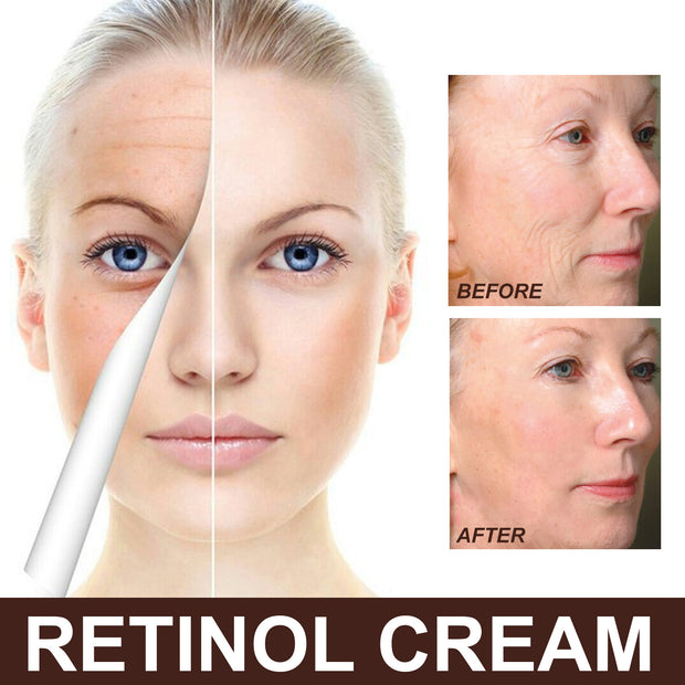 EELHOE Retinol Cream