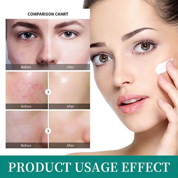 Retinol Black Cream Night Cream Moisturizing null