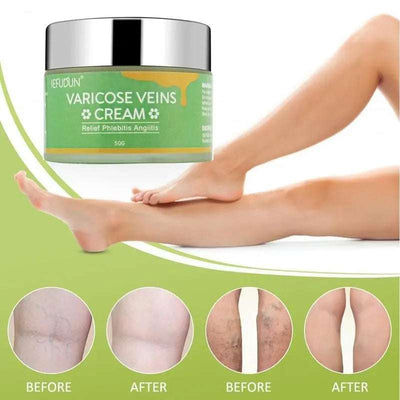Vein Cream Red Blood Streaks Repair Earthworm Leg Bruises Bulge Relief Pain Safflower Skin care lotion Varicose Cream null